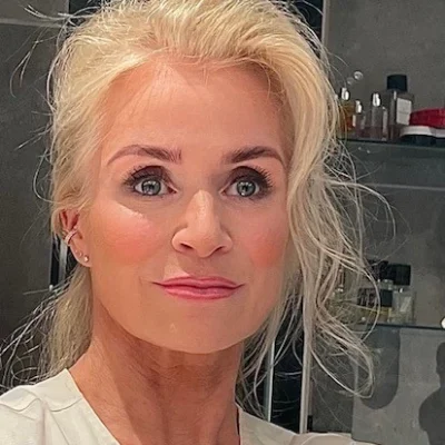 Lise Merete Johnsen, kosmetisk dermatologisk sykepleier og eier av Drøbak Medisinske Hudpleie